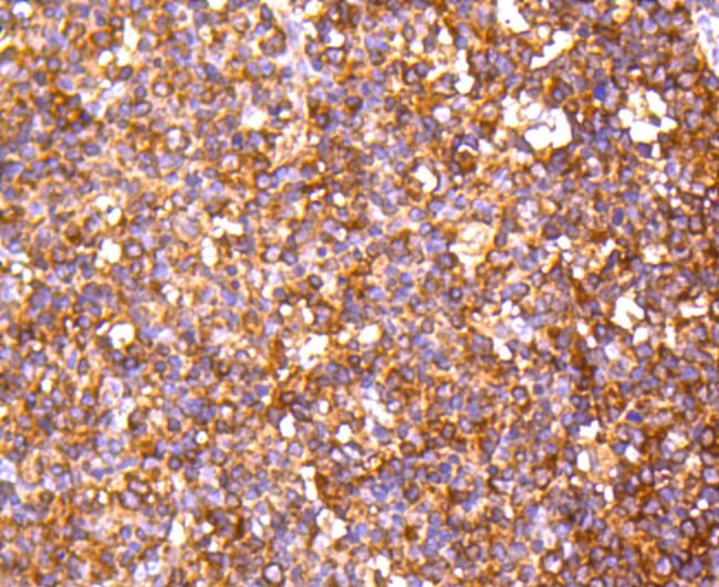 PP2A alpha/beta Antibody in Immunohistochemistry (Paraffin) (IHC (P))