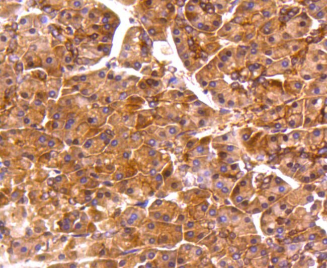 PP2A alpha/beta Antibody in Immunohistochemistry (Paraffin) (IHC (P))