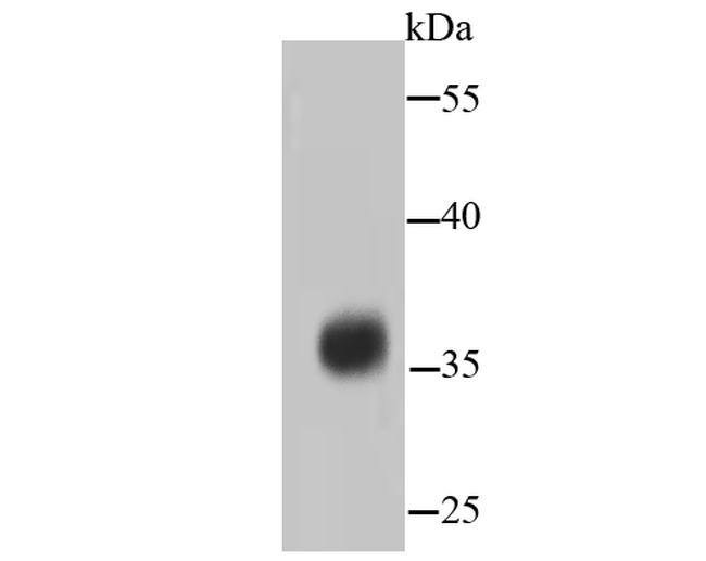 PP2A alpha/beta Antibody in Western Blot (WB)