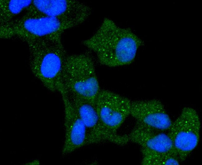 Cytokeratin 13 Antibody in Immunocytochemistry (ICC/IF)