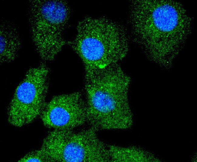 Cytokeratin 13 Antibody in Immunocytochemistry (ICC/IF)