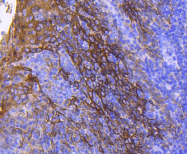 Cytokeratin 13 Antibody in Immunohistochemistry (Paraffin) (IHC (P))