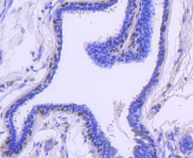 Cytokeratin 13 Antibody in Immunohistochemistry (Paraffin) (IHC (P))