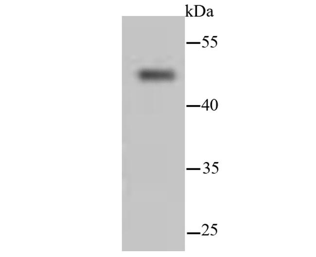 Cytokeratin 13 Antibody in Western Blot (WB)