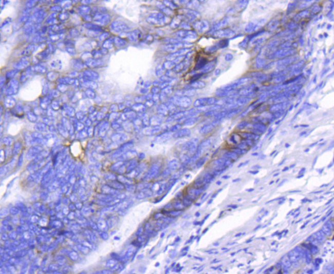 CD49b (Integrin alpha 2) Antibody in Immunohistochemistry (Paraffin) (IHC (P))