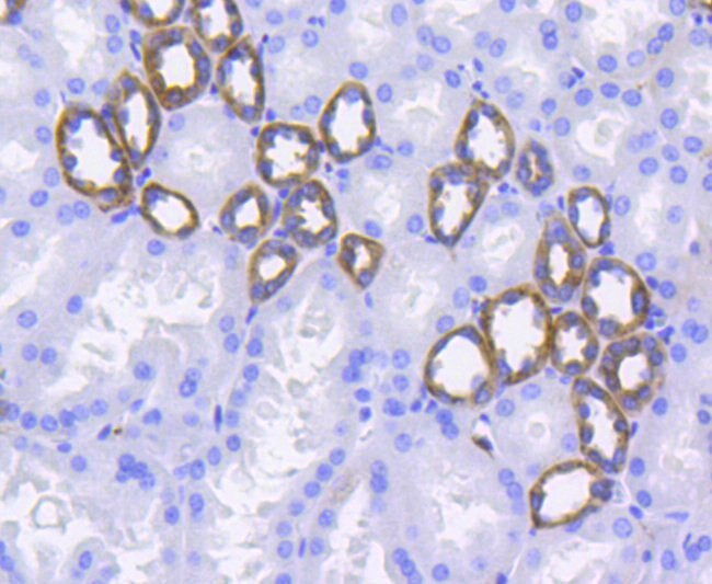 CD49b (Integrin alpha 2) Antibody in Immunohistochemistry (Paraffin) (IHC (P))