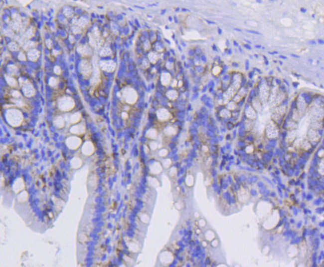 CD49b (Integrin alpha 2) Antibody in Immunohistochemistry (Paraffin) (IHC (P))