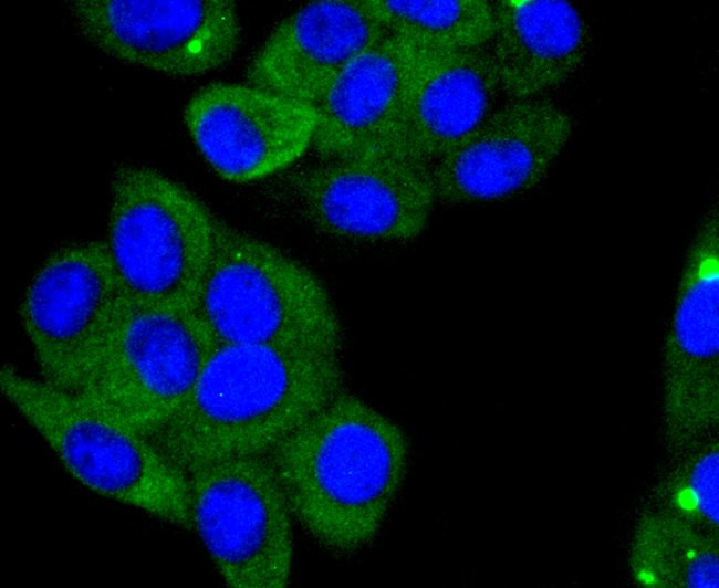 ACE2 Antibody in Immunocytochemistry (ICC/IF)