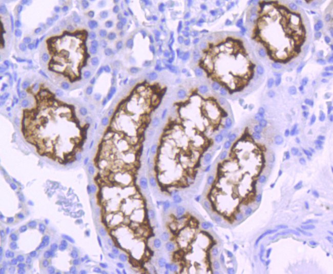 ACE2 Antibody in Immunohistochemistry (Paraffin) (IHC (P))