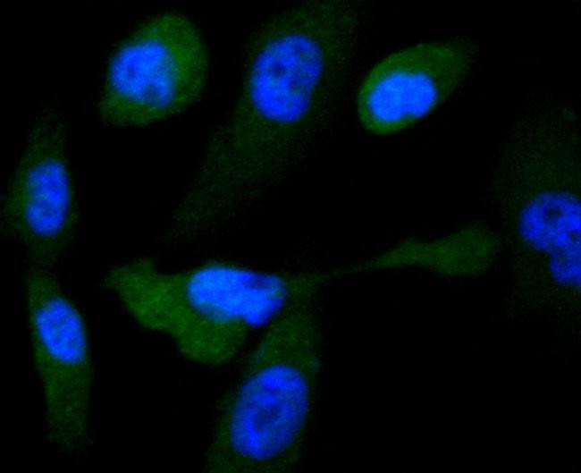 GYS1 Antibody in Immunocytochemistry (ICC/IF)