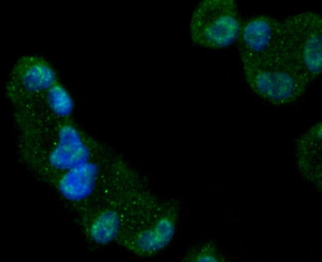 GYS1 Antibody in Immunocytochemistry (ICC/IF)