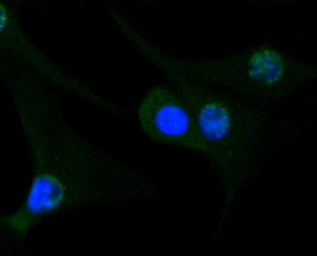 GYS1 Antibody in Immunocytochemistry (ICC/IF)