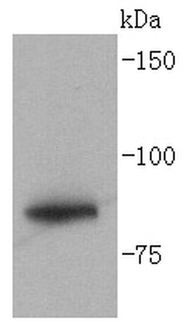 GYS1 Antibody in Western Blot (WB)