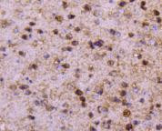 PPP1R1A Antibody in Immunohistochemistry (Paraffin) (IHC (P))