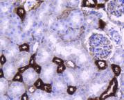 PPP1R1A Antibody in Immunohistochemistry (Paraffin) (IHC (P))