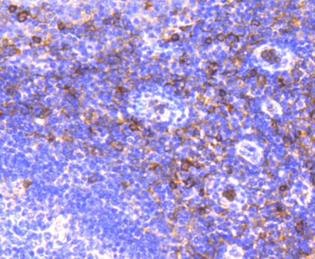 CD13 Antibody in Immunohistochemistry (Paraffin) (IHC (P))