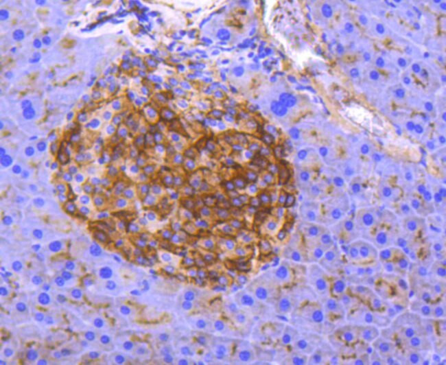 CD13 Antibody in Immunohistochemistry (Paraffin) (IHC (P))