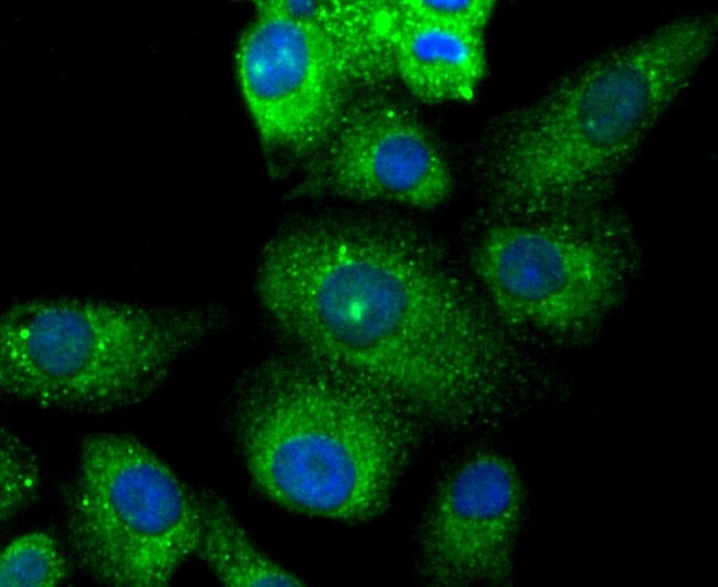 PYCARD Antibody in Immunocytochemistry (ICC/IF)