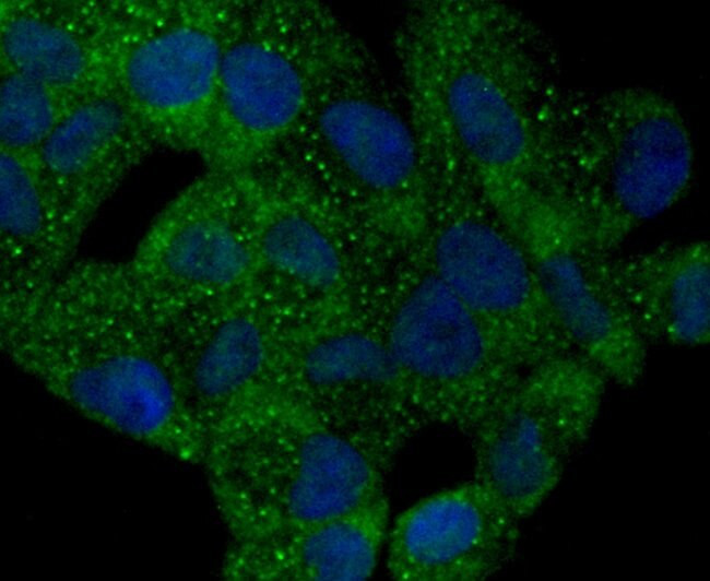 PYCARD Antibody in Immunocytochemistry (ICC/IF)