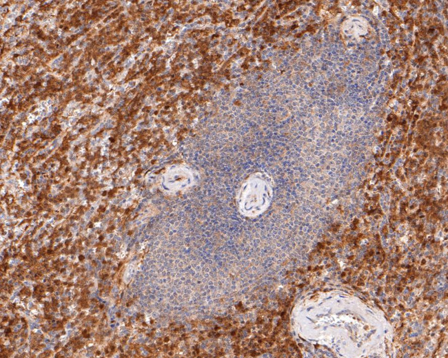 PYCARD Antibody in Immunohistochemistry (Paraffin) (IHC (P))