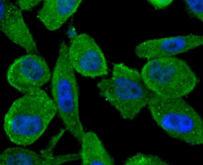 ABCF1 Antibody in Immunocytochemistry (ICC/IF)