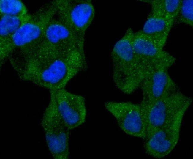 ABCF1 Antibody in Immunocytochemistry (ICC/IF)