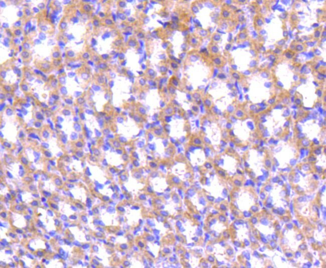 ABCF1 Antibody in Immunohistochemistry (Paraffin) (IHC (P))