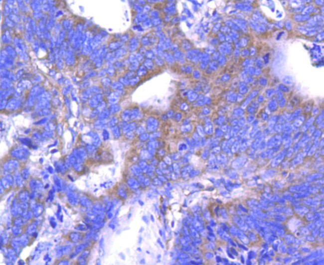 ABCF1 Antibody in Immunohistochemistry (Paraffin) (IHC (P))