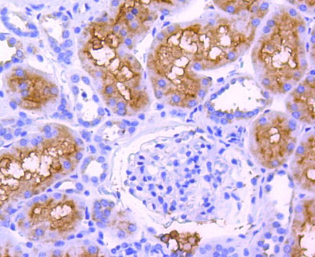 ABCF1 Antibody in Immunohistochemistry (Paraffin) (IHC (P))