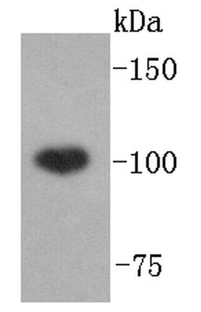 ABCF1 Antibody in Western Blot (WB)