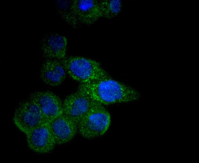 CPT2 Antibody in Immunocytochemistry (ICC/IF)