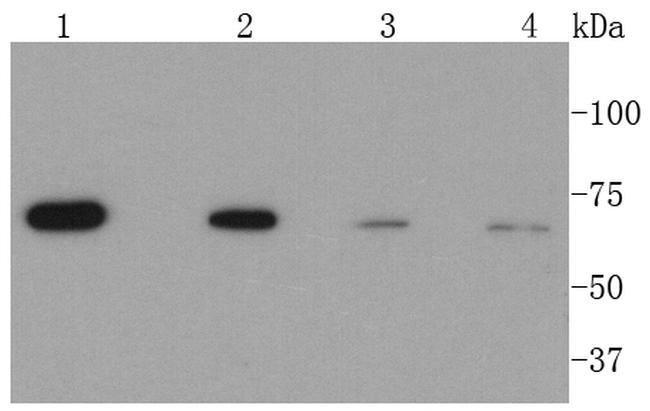 CPT2 Antibody in Western Blot (WB)