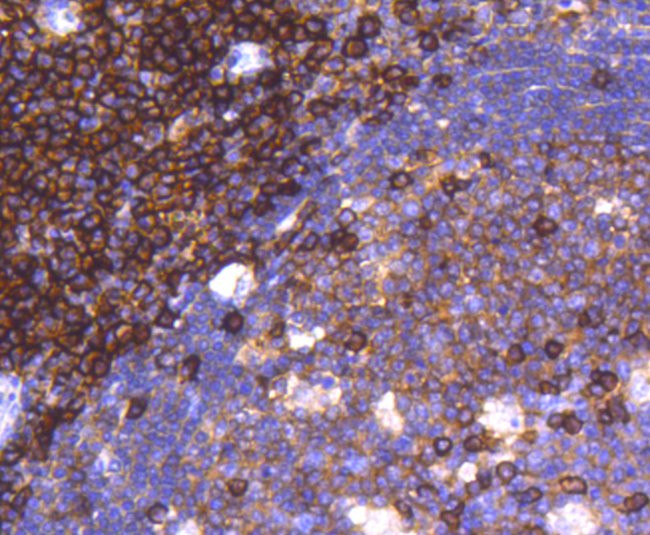 CD38 Antibody in Immunohistochemistry (Paraffin) (IHC (P))