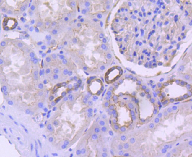 CD38 Antibody in Immunohistochemistry (Paraffin) (IHC (P))