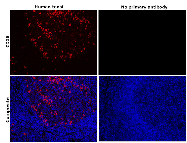 CD38 Antibody in Immunohistochemistry (Paraffin) (IHC (P))