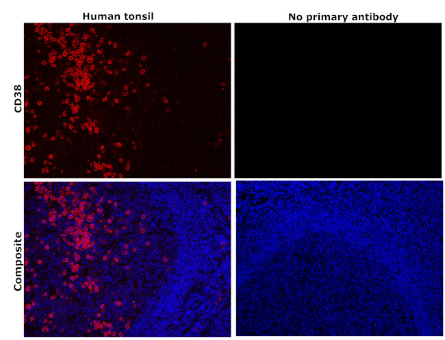 CD38 Antibody in Immunohistochemistry (Paraffin) (IHC (P))