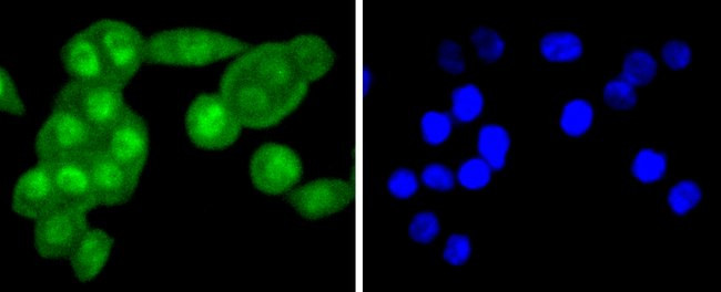 FANCD2 Antibody in Immunocytochemistry (ICC/IF)