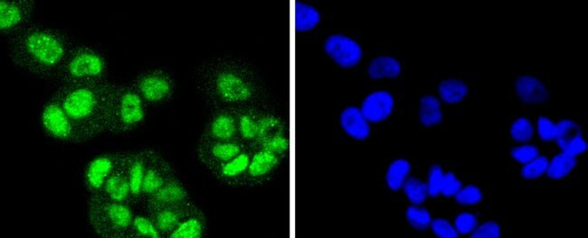 FANCD2 Antibody in Immunocytochemistry (ICC/IF)