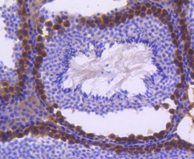 FANCD2 Antibody in Immunohistochemistry (Paraffin) (IHC (P))