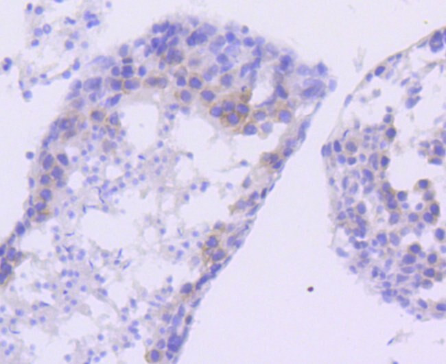 FANCD2 Antibody in Immunohistochemistry (Paraffin) (IHC (P))