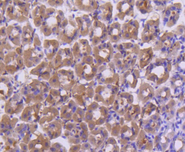 FANCD2 Antibody in Immunohistochemistry (Paraffin) (IHC (P))