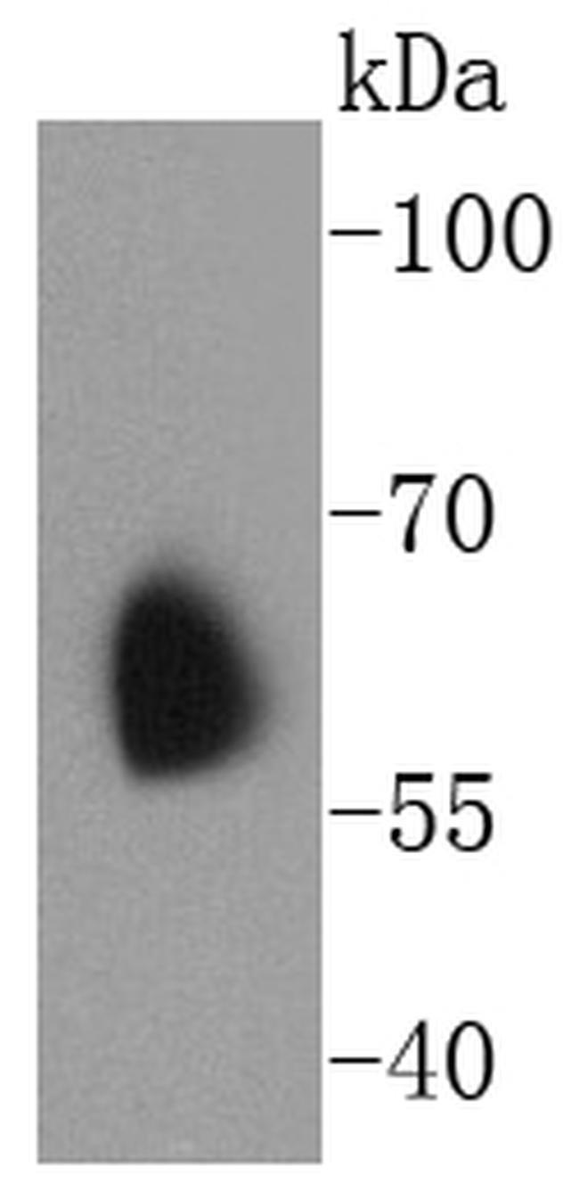 KV1.1 (KCNA1) Antibody in Western Blot (WB)