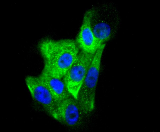 Cytokeratin 6 Antibody in Immunocytochemistry (ICC/IF)