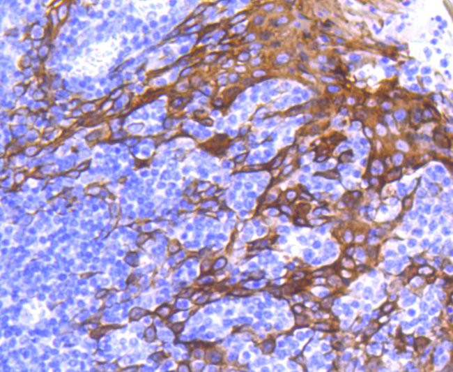 Cytokeratin 6 Antibody in Immunohistochemistry (Paraffin) (IHC (P))