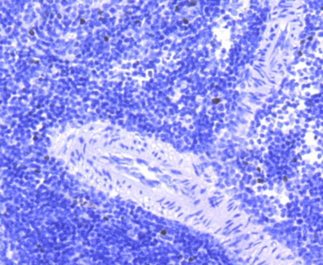 FosB Antibody in Immunohistochemistry (Paraffin) (IHC (P))