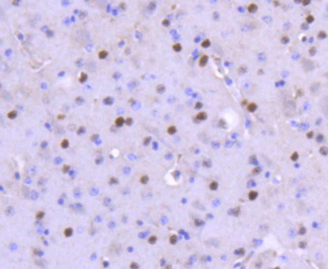 FosB Antibody in Immunohistochemistry (Paraffin) (IHC (P))