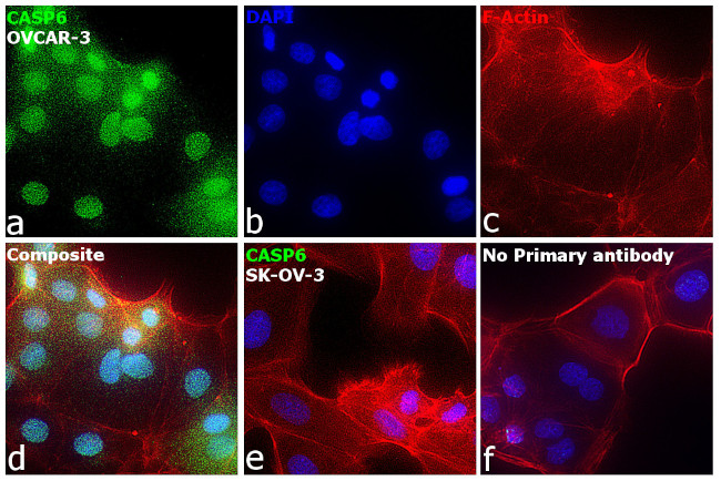 Caspase 6 p18 Antibody in Immunocytochemistry (ICC/IF)