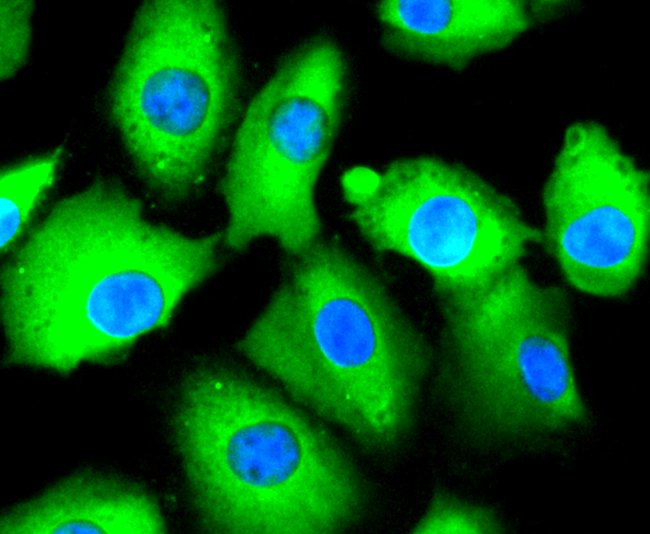 CD81 Antibody in Immunocytochemistry (ICC/IF)