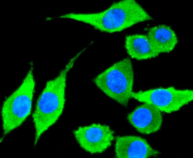 CD81 Antibody in Immunocytochemistry (ICC/IF)