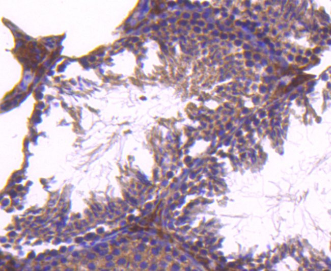 CD81 Antibody in Immunohistochemistry (Paraffin) (IHC (P))